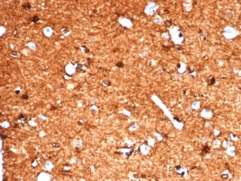 Recombinant S100B Antibody / Rabbit Monoclonal