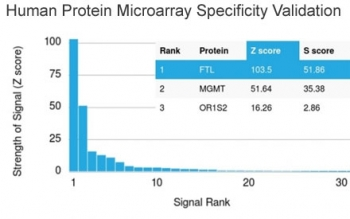 Ferritin Light Chain Antibody