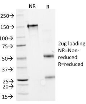 Interferon alpha 2 Antibody