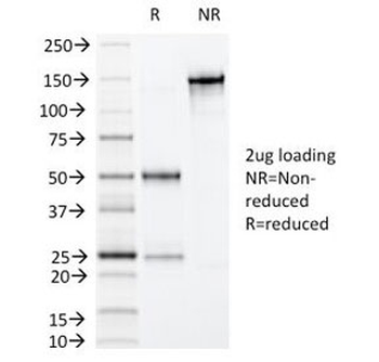Villin Antibody / VIL1