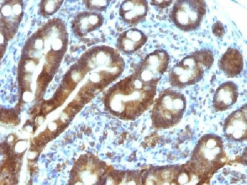 TDP2 Antibody / Tyrosyl-DNA phosphodiesterase 2 / ETS1 associated protein II