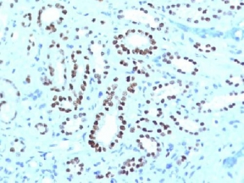 PAX8 Antibody Cocktail