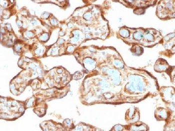 Thymidine Phosphorylase Antibody / PD-ECGF