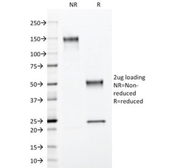 S100B Antibody