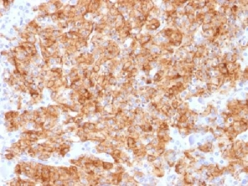 Recombinant Chromogranin A Antibody / Rabbit Monoclonal