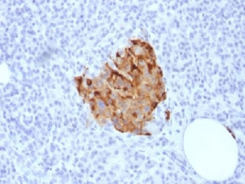 Recombinant Chromogranin A Antibody / Rabbit Monoclonal