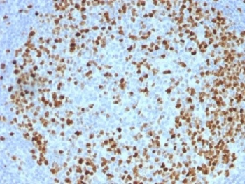 TOP2A Antibody / Topoisomerase II alpha