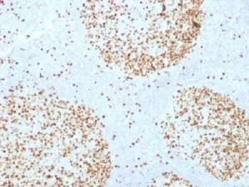 Topoisomerase II alpha Antibody / TOP2A