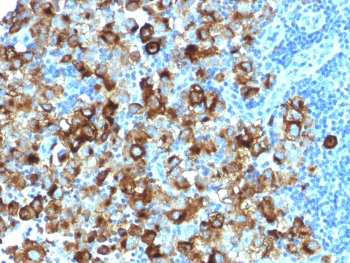 Recombinant gp100 Antibody / PMEL17 / Rabbit Monoclonal