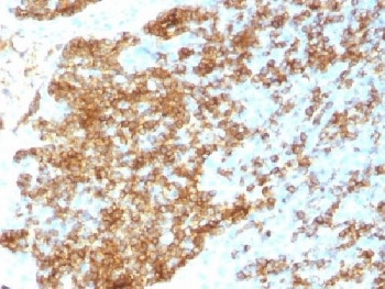 Recombinant CD45RB Antibody / Rabbit Monoclonal