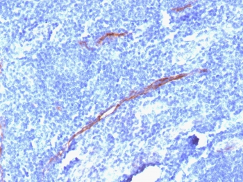 Recombinant CD34 Antibody / Rabbit Monoclonal