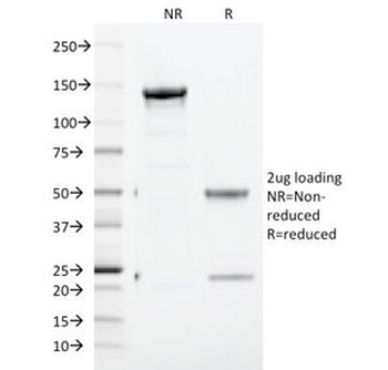 CD71 Antibody / Transferrin Receptor (Extracellular domain)
