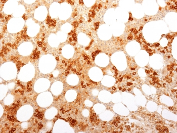 Transferrin Receptor Antibody / CD71 (Extracellular domain)