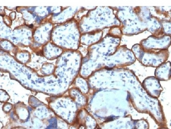 Transferrin Receptor Antibody / CD71 (Extracellular domain)