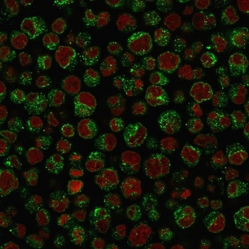 Recombinant CD79a Antibody / Rabbit Monoclonal