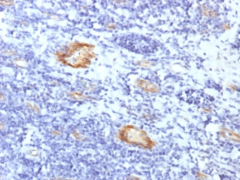 Recombinant vWF Antibody
