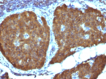 Neuron Specific Enolase Antibody / NSE