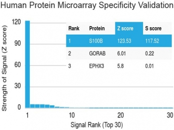 S100 beta Antibody