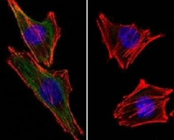 S100 beta Antibody
