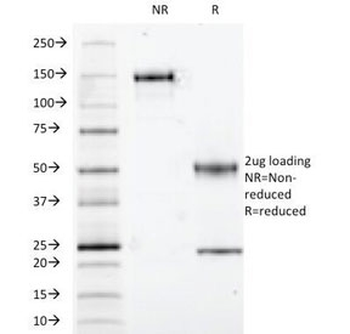 S100 beta Antibody