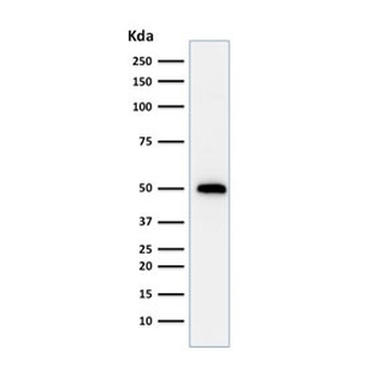 TP53 Antibody