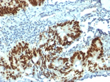 p53 Antibody (N-Terminal Region)