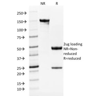 TYRP1 Antibody / Tyrosinase-Related Protein-1 / TRP1