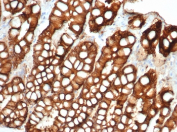 EpCAM Antibody / Extracellular domain
