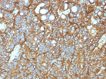 EpCAM Antibody / Extracellular domain