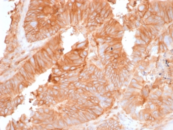 Recombinant Beta-2 Microglobulin Antibody