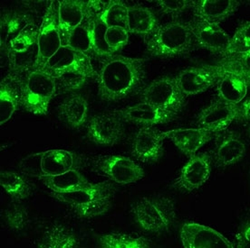 Recombinant Beta-2 Microglobulin Antibody