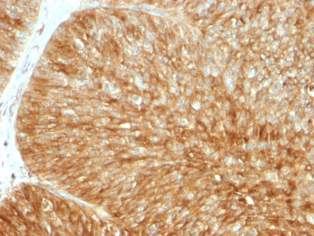 Recombinant B2M Antibody / Beta-2 Microglobulin