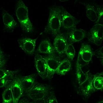 Recombinant B2M Antibody / Beta-2 Microglobulin