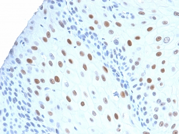 Recombinant CDNK1A Antibody / p21
