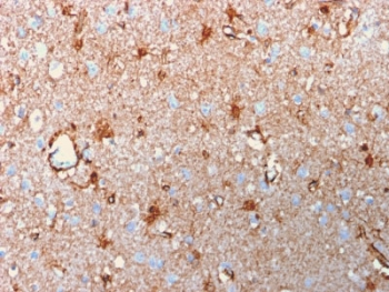 Recombinant S100B Antibody