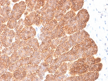 Recombinant EpCAM Antibody / Extracellular domain