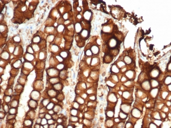 Recombinant EpCAM Antibody / Extracellular domain