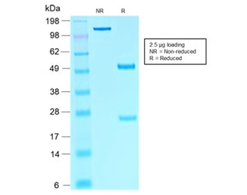 Recombinant SOX10 Antibody