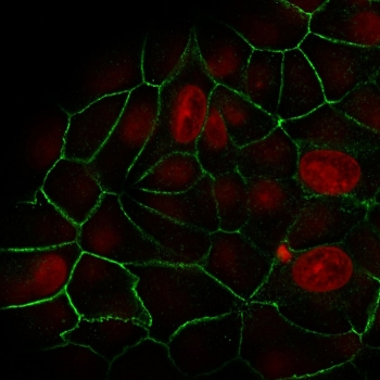Recombinant E-Cadherin Antibody