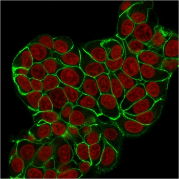 Recombinant E-Cadherin Antibody / Rabbit Monoclonal
