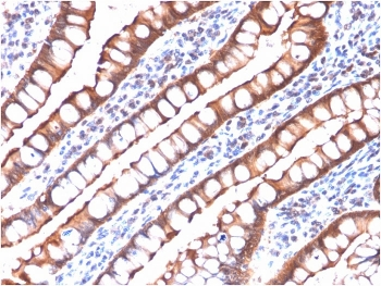 Recombinant Villin Antibody / VIL1