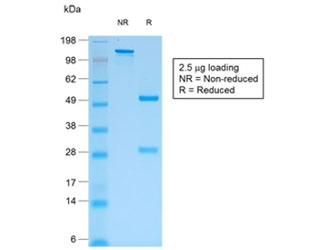 Recombinant Human IgG Antibody