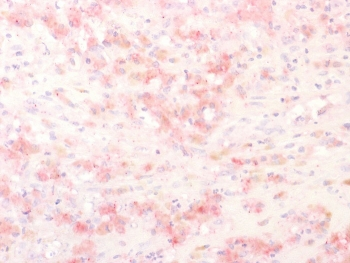 Recombinant TRP1 Antibody / Tyrosinase Related Protein 1 / TYRP1