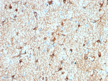 Recombinant GFAP Antibody / Rabbit Monoclonal
