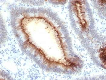 Recombinant CEA Antibody / CEACAM5