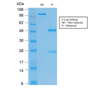 Recombinant CEA Antibody / CEACAM5