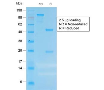 Recombinant CEA Antibody / CEACAM5