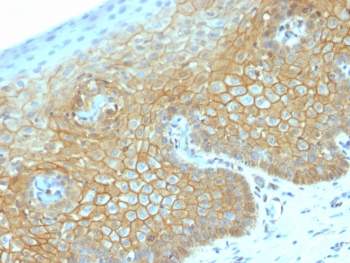 Recombinant b-Catenin Antibody