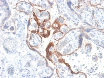 Recombinant HCG-beta Antibody / Rabbit Monoclonal