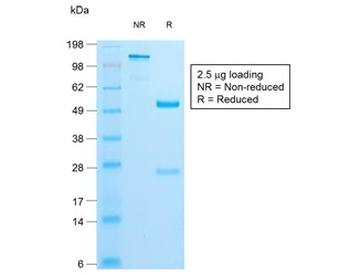 Recombinant INS Antibody / Insulin